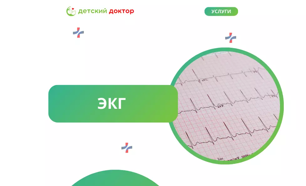 ЭКГ